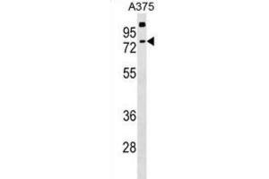Western Blotting (WB) image for anti-Transketolase-Like 2 (TKTL2) antibody (ABIN2999404)