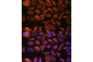 Immunofluorescence analysis of U-2 OS cells using Alpha Fodrin antibody (ABIN6128747, ABIN6148403, ABIN6148404 and ABIN6213643) at dilution of 1:100. (SPTAN1 antibody  (AA 950-1130))