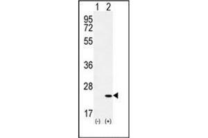 Western blot analysis of CRH (arrow) using Corticoliberin Antibody (C-term) Cat. (CRH antibody  (C-Term))
