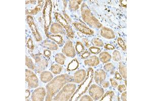 Immunohistochemistry of paraffin-embedded rat kidney using NPHP1 Rabbit pAb (ABIN6128349, ABIN6144768, ABIN6144769 and ABIN6222377) at dilution of 1:50 (40x lens).