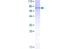 Image no. 2 for Mitogen-Activated Protein Kinase-Activated Protein Kinase 5 (MAPKAPK5) (AA 1-471) protein (GST tag) (ABIN1310330) (MAPKAP Kinase 5 Protein (AA 1-471) (GST tag))