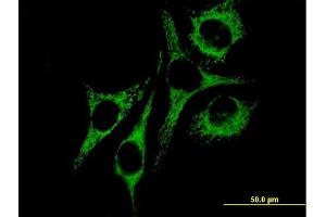 Immunofluorescence of purified MaxPab antibody to HSPD1 on HeLa cell. (HSPD1 antibody  (AA 1-573))