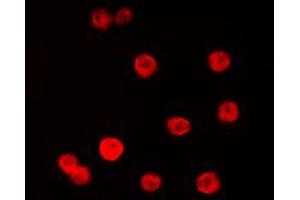 Immunofluorescent analysis of SP1 staining in K562 cells. (SP1 antibody  (Center))