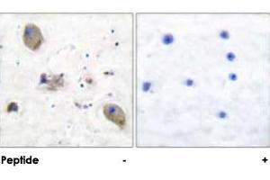Immunohistochemical analysis of paraffin-embedded human brain tissue using LYN polyclonal antibody . (CD180 antibody)