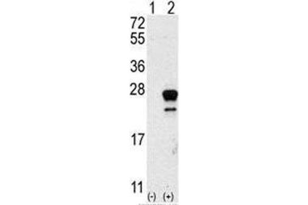 GTPase NRas Antikörper  (AA 72-101)