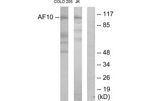 Western blot analysis of extracts from COLO205 cells and Jurkat cells, using AF10 antibody. (MLLT10 antibody  (Internal Region))