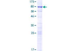 SRFBP1 Protein (AA 1-429) (GST tag)