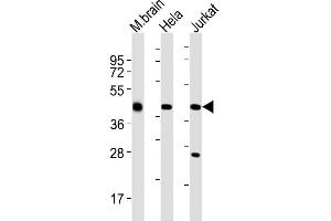 All lanes : Anti-GLUL Antibody (N-term) at 1:2000 dilution Lane 1: mouse brain lysates Lane 2: Hela whole cell lysates Lane 3: Jurkat whole cell lysates Lysates/proteins at 20 μg per lane. (GLUL antibody  (N-Term))