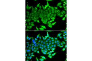 Immunofluorescence analysis of A549 cells using TTF2 antibody. (TTF2 antibody)