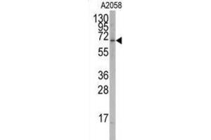 Western Blotting (WB) image for anti-RAR-Related Orphan Receptor A (RORA) antibody (ABIN2995882)