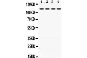 Western Blotting (WB) image for anti-Nuclear Receptor Subfamily 3, Group C, Member 2 (NR3C2) (AA 950-984), (C-Term) antibody (ABIN3043575) (NR3C2 antibody  (C-Term))