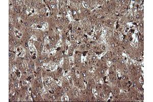 Image no. 1 for anti-Tripartite Motif Containing 38 (TRIM38) (AA 1-265) antibody (ABIN1490685) (TRIM38 antibody  (AA 1-265))