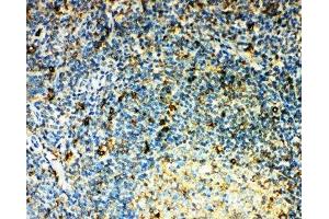 IHC-P: CCR3 antibody testing of human tonsil tissue (CCR3 antibody  (N-Term))