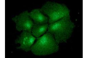 ICC/IF analysis of BMP2 in Hep3B cells line, stained with monoclonal anti-human BMP2 antibody (1:100) with goat anti-mouse IgG-Alexa fluor 488 conjugate (Green). (BMP2 antibody  (AA 283-396))