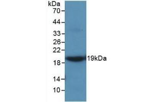 Detection of Recombinant MMP9, Rat using Monoclonal Antibody to Matrix Metalloproteinase 9 (MMP9) (MMP 9 antibody  (AA 226-391))