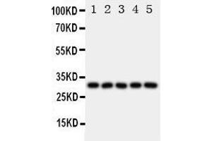 Anti-LOX 1 antibody, Western blotting All lanes: Anti LOX 1  at 0.