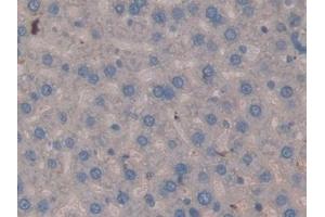 Detection of MMP3 in Rat Liver Tissue using Polyclonal Antibody to Matrix Metalloproteinase 3 (MMP3) (MMP3 antibody  (AA 98-475))