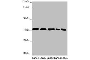 Western blot All lanes: GNB2 antibody at 2. (GNB2 antibody  (AA 1-340))