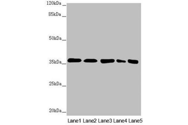 GNB2 Antikörper  (AA 1-340)