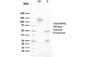 SDS-PAGE Analysis Purified TFF1/ps2 Mouse Monoclonal Antibody (TFF1/2133). (TFF1 antibody)