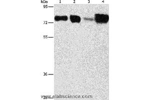 Western blot analysis of Hepg2 and hela cell, human fetal kidney and liver tissue, using ACSL4 Polyclonal Antibody at dilution of 1:650