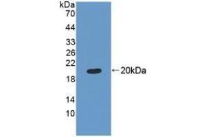 Detection of Recombinant MRPL1, Human using Polyclonal Antibody to Mitochondrial Ribosomal Protein L1 (MRPL1) (MRPL1 antibody  (AA 147-285))