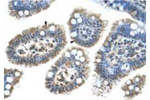 Image no. 1 for anti-Sonic Hedgehog (SHH) (N-Term) antibody (ABIN6736667) (Sonic Hedgehog antibody  (N-Term))