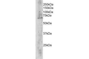 Image no. 1 for anti-Transducin (Beta)-Like 1X-Linked (TBL1X) (C-Term) antibody (ABIN374165)