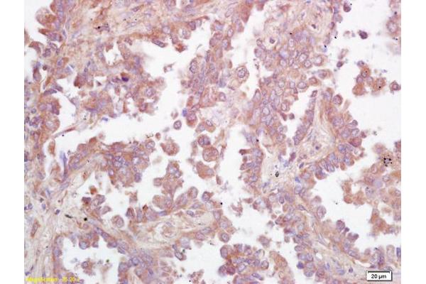 UGCG antibody  (AA 21-120)