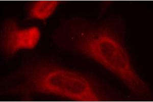 Immunofluorescence analysis of methanol-fixed HeLa cells using Phospho-STAT1(S727) Polyclonal Antibody (STAT1 antibody  (pSer727))