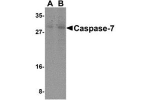 Western Blotting (WB) image for anti-Caspase 7, Apoptosis-Related Cysteine Peptidase (CASP7) (N-Term) antibody (ABIN1031300) (Caspase 7 antibody  (N-Term))