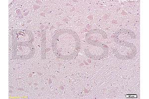 Formalin-fixed and paraffin embedded: rat brain tissue labeled with Anti-MAP1A Polyclonal Antibody (ABIN735308), Unconjugated at 1:200, followed by conjugation to the secondary antibody and DAB staining (MAP1A antibody  (AA 2651-2750))