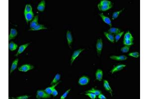 Immunofluorescent analysis of Hela cells using ABIN7168833 at dilution of 1:100 and Alexa Fluor 488-congugated AffiniPure Goat Anti-Rabbit IgG(H+L) (SENP1 antibody  (AA 63-214))