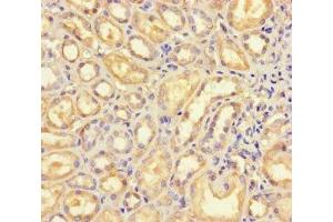 Immunohistochemistry of paraffin-embedded human kidney tissue using ABIN7145396 at dilution of 1:100 (B4GALT5 antibody  (AA 101-388))