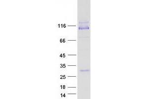Validation with Western Blot (IMPG1 Protein (Myc-DYKDDDDK Tag))