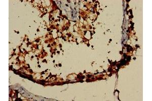 Immunohistochemistry of paraffin-embedded human testis tissue using ABIN7161885 at dilution of 1:100 (PPP1R9A antibody  (AA 1-243))