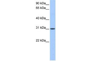 WB Suggested Anti-HUS1B Antibody Titration: 0.