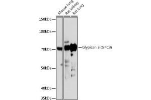 Western blot analysis of extracts of various cell lines, using Glypican 3 (GPC3) (GPC3) antibody (ABIN6127987, ABIN6141306, ABIN6141310 and ABIN6219094) at 1:1000 dilution. (Glypican 3 antibody  (AA 290-550))