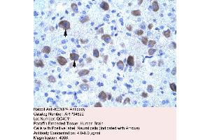 Human Brain (KCNIP4 antibody  (N-Term))