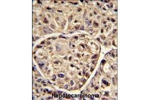 Immunohistochemistry (Paraffin-embedded Sections) (IHC (p)) image for anti-ELOVL Fatty Acid Elongase 6 (ELOVL6) (AA 32-58), (N-Term) antibody (ABIN390425)