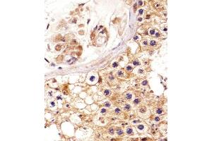 Immunohistochemical analysis of paraffin-embedded H. (EPH Receptor A4 antibody  (AA 383-417))