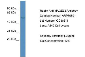 WB Suggested Anti-MAGEL2  Antibody Titration: 0. (MAGE-Like 2 antibody  (N-Term))