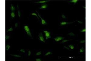 Immunofluorescence of monoclonal antibody to SOD1 on HeLa cell. (SOD1 antibody  (AA 1-154))