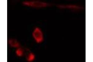 ABIN6275892 staining  Hela cells by IF/ICC. (FTH1 antibody  (C-Term))