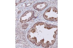 Immunohistochemical analysis of (ABIN656404 and ABIN2845698) on paraffin-embedded Human prostate tissue. (WFDC1 antibody  (C-Term))