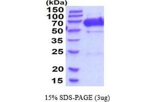 SDS-PAGE (SDS) image for Fibronectin Leucine Rich Transmembrane Protein 2 (FLRT2) (AA 36-541) protein (His tag) (ABIN6387748)