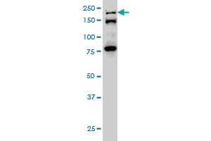 ESPL1 monoclonal antibody (M01), clone 6H6 Western Blot analysis of ESPL1 expression in Hela S3 NE . (Separase antibody  (AA 586-701))