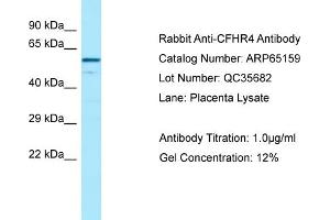 Western Blotting (WB) image for anti-Complement Factor H-Related 4 (CFHR4) (C-Term) antibody (ABIN2790060) (CFHR4 antibody  (C-Term))