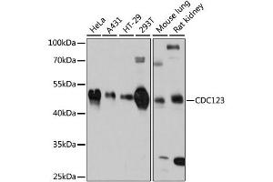 Western blot analysis of extracts of various cell lines, using CDC123 antibody (ABIN4903209) at 1:3000 dilution.