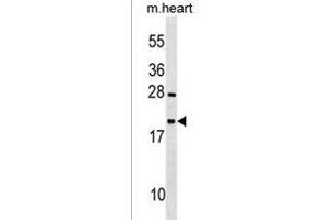 TEX12 Antibody (Center) (ABIN1538318 and ABIN2850043) western blot analysis in mouse heart tissue lysates (35 μg/lane). (TEX12 antibody  (AA 34-63))